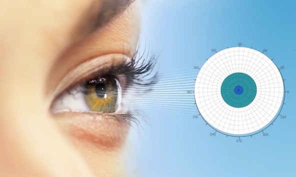 Contoura Vision Diagram